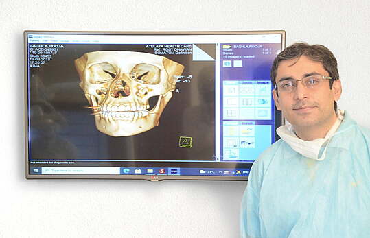 All-on-4 Denture Implants