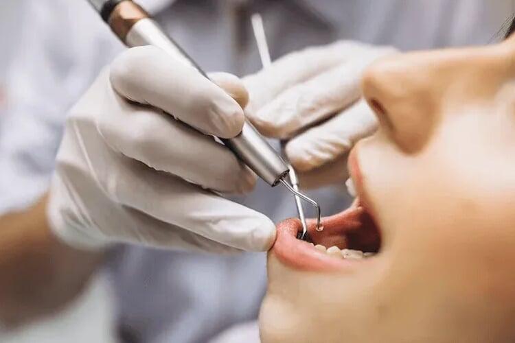 A Complete Guide to Root Canal Treatment: What to Expect & Benefits