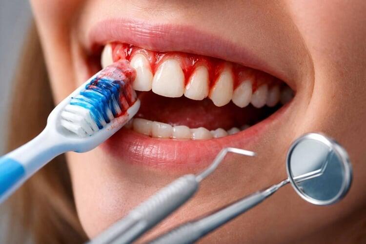 A Complete Guide to Root Canal Treatment: What to Expect & Benefits