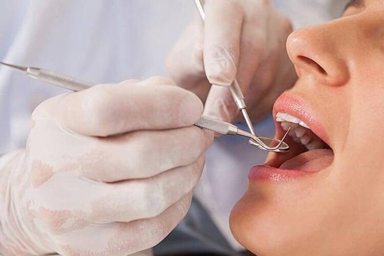 How Often Should I Really Visit the Dentist?