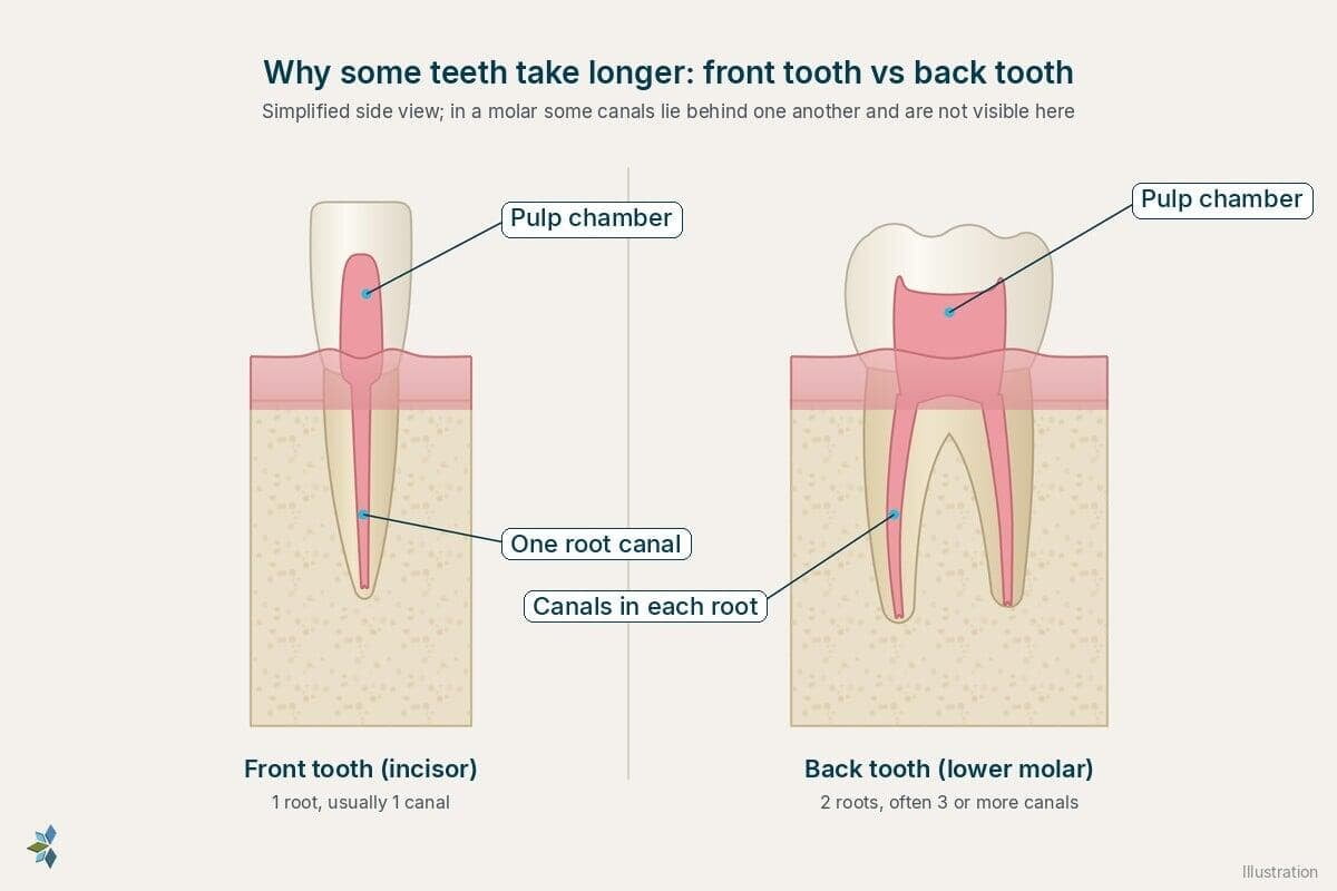 Two teeth in side view: a front tooth with one root and one canal, and a lower molar with two roots and canals in each root
