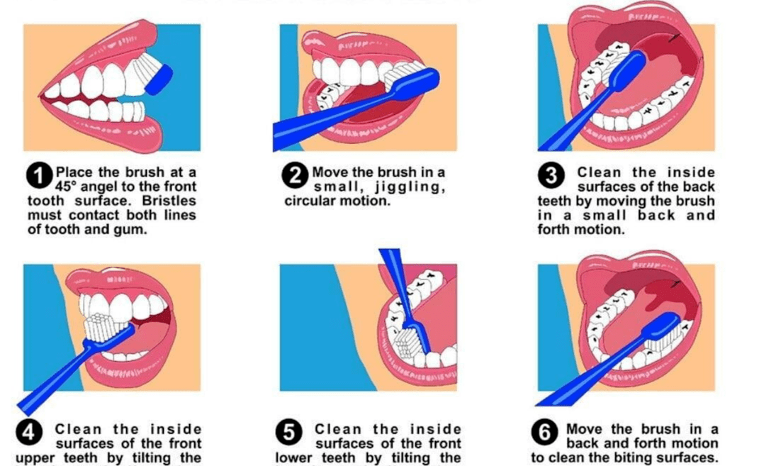 brushing technique