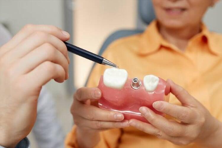 Common Implant Complications & How to Avoid Them