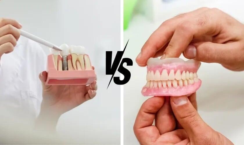 Dentures vs. Implants: How to Choose the Right Option for You