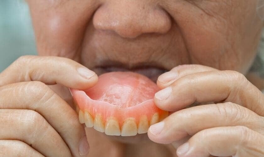 Loose Dentures in Chandigarh? Implant-Supported Dentures Explained