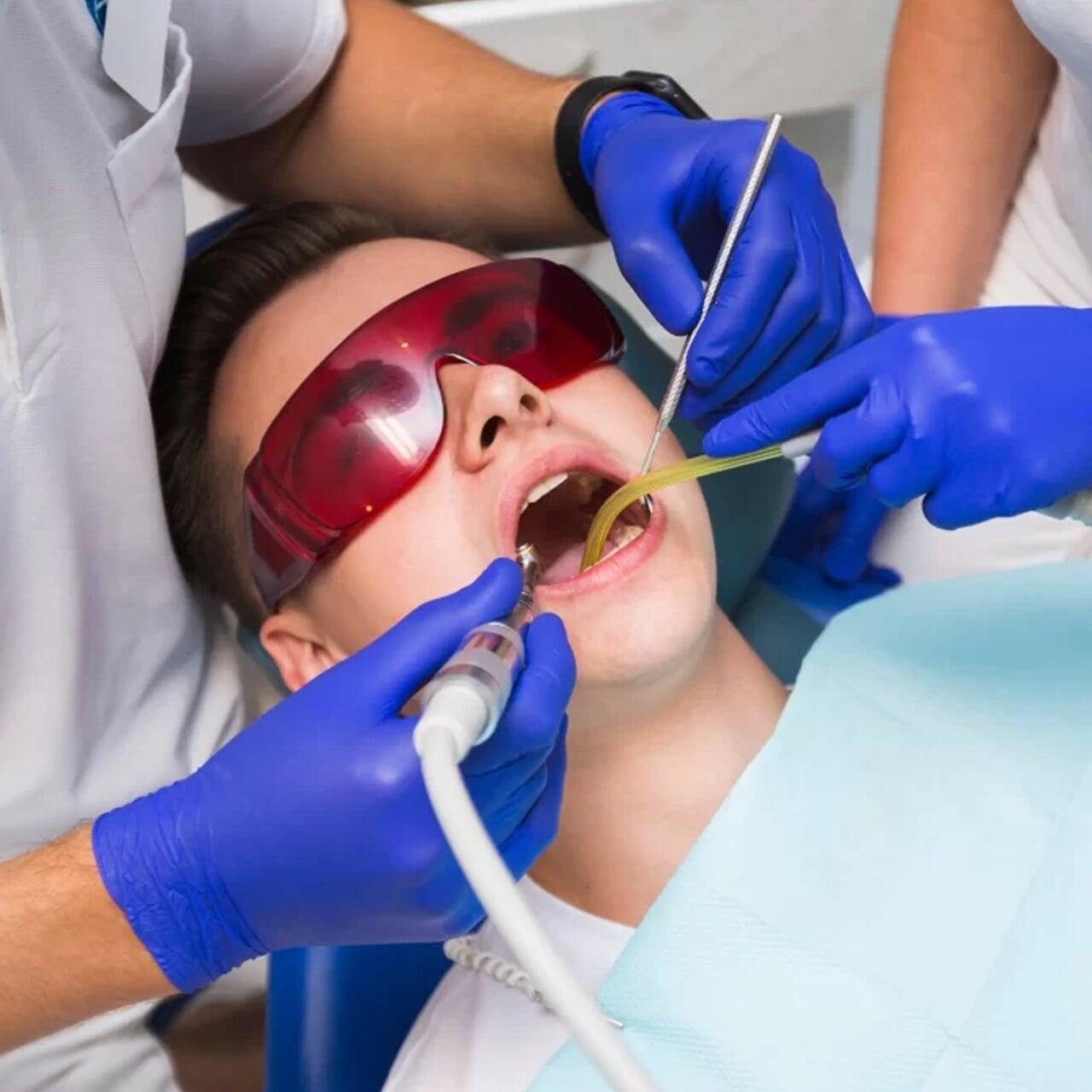Is Root Canal Treatment Painful? Myths vs. Facts