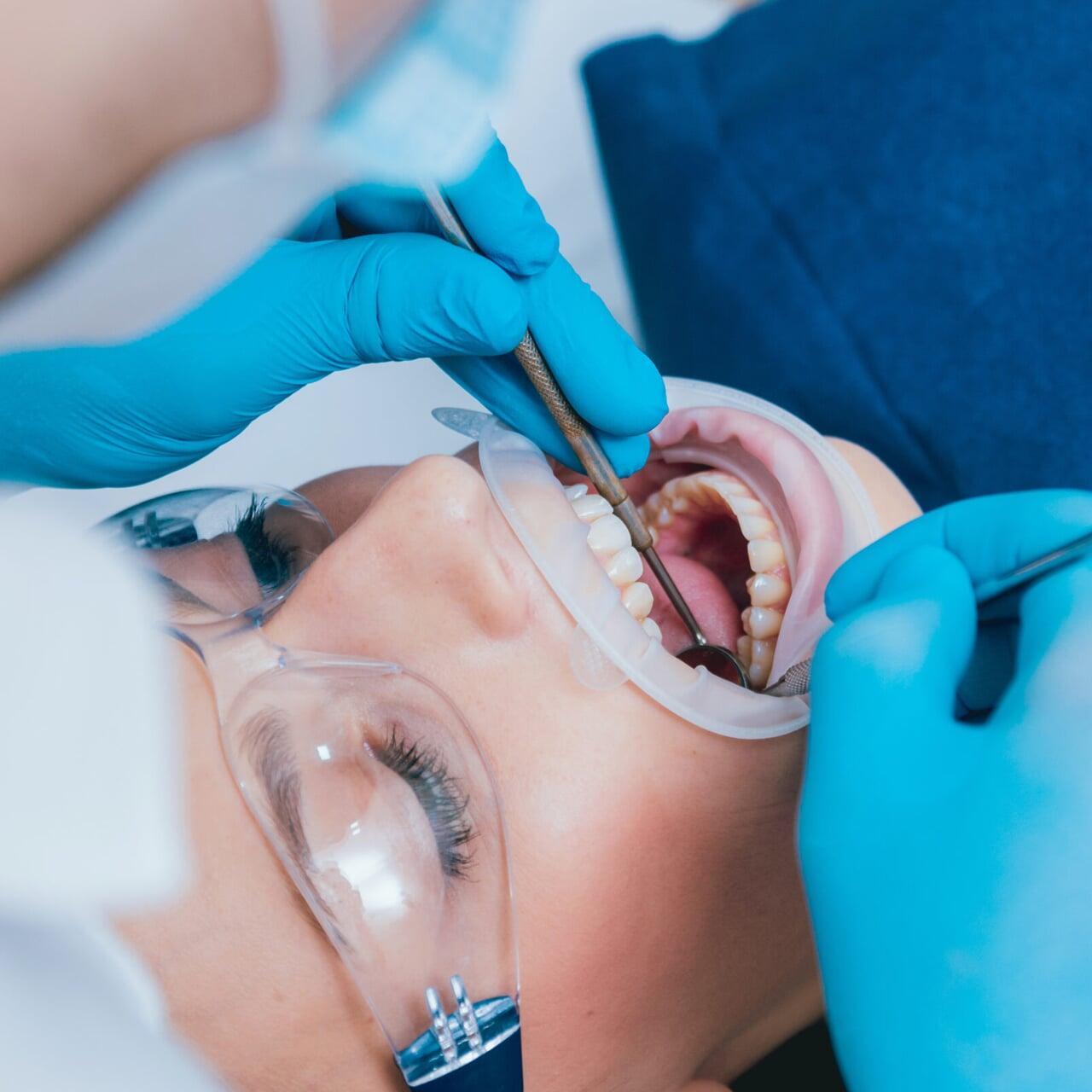 How Root Canal Treatment Saves Your Natural Teeth