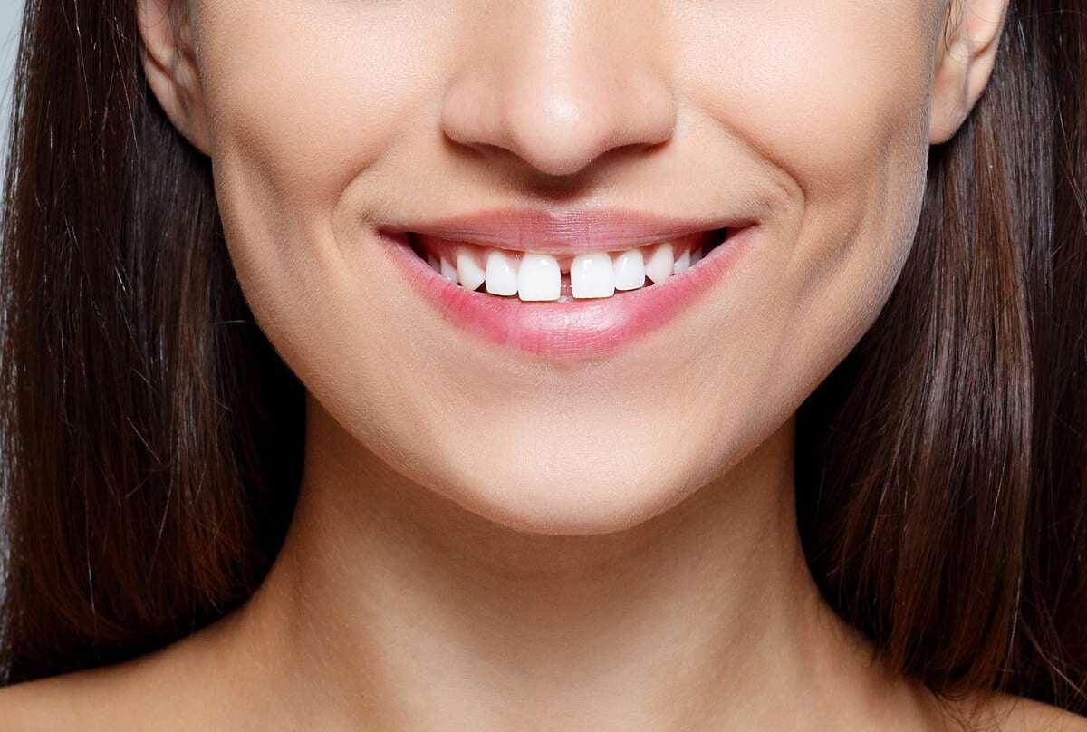 Living with Dentures